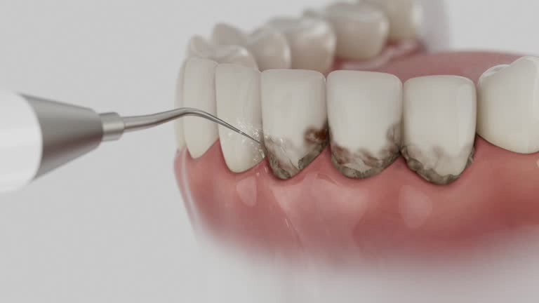 Trusted Teeth Cleaning And Checkup service in West Alexandria, OH - Dentist Open Now